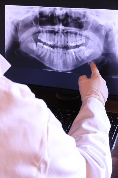 Best Emergency Wisdom Tooth Extraction in Cockeysville, MD