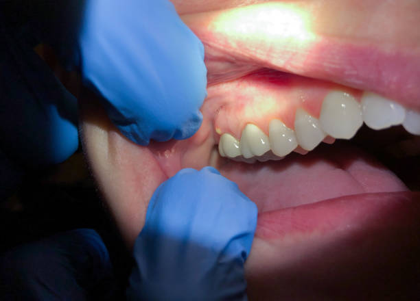 Best Weekend Emergency Dental Services in Cockeysville, MD